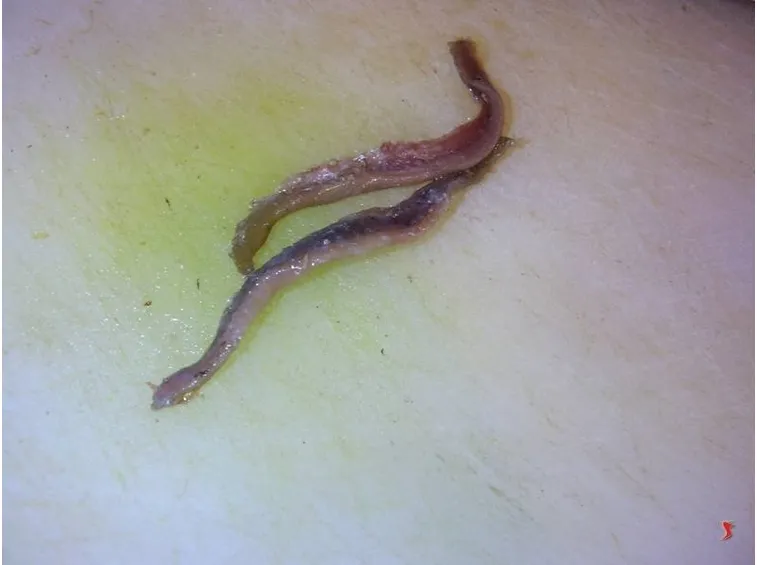 acciughe