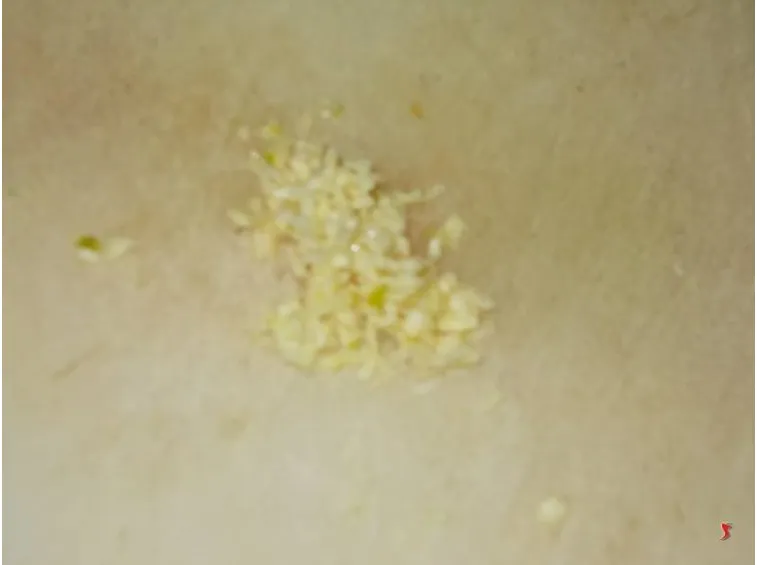 aglio 